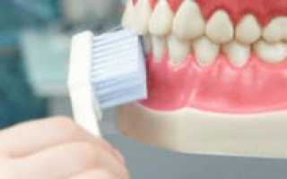 Выбор щетки для очистки брекетов и обзор щеток «Oral B»