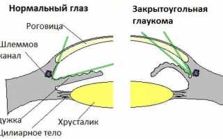 Катаракта и глаукома – различия, признаки, лечение и профилактика