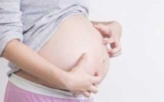 Застой желчи у беременных женщин: симптомы, причины и лечение холестаза