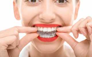 Причины искривления зубов после ношения брекетов