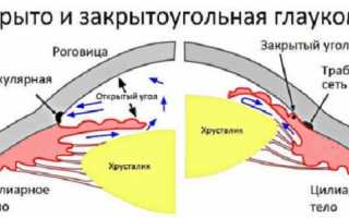 Упражнения для глаз при глаукоме: гимнастика и массаж